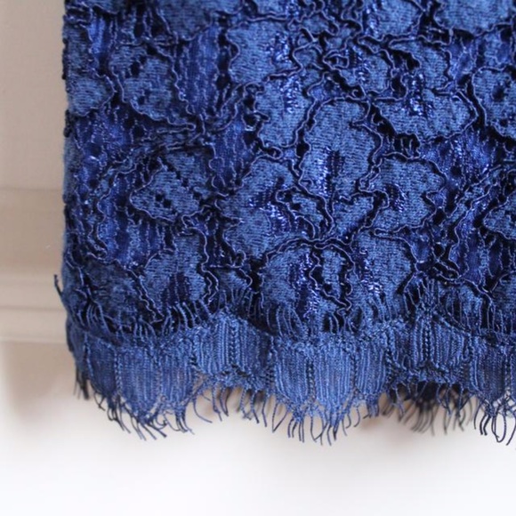 DVF Blue Lace Dress- Wanda - Picture 4 of 7